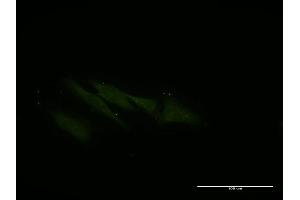 Immunofluorescence of monoclonal antibody to VPS16 on HeLa cell. (VPS16 antibody  (AA 754-839))