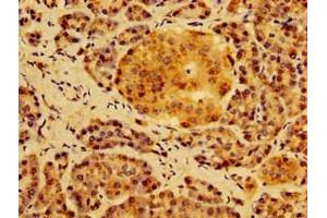 Immunohistochemistry of paraffin-embedded human pancreatic tissue using ABIN7155006 at dilution of 1:100 (HS2ST1 antibody  (AA 29-229))