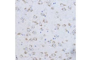 Immunohistochemistry of paraffin-embedded mouse brain using FAK Rabbit pAb (ABIN6131638, ABIN6146424, ABIN6146426 and ABIN6215254) at dilution of 1:100 (40x lens). (FAK antibody  (AA 425-660))