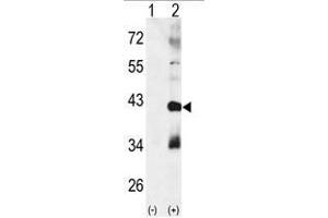 Western blot analysis of CTDSP1 (arrow) using rabbit polyclonal p38 beta Antibody (MAPK11 antibody  (Middle Region))