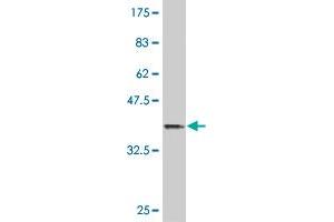 Western Blot detection against Immunogen (36. (HOXB9 antibody  (AA 65-163))