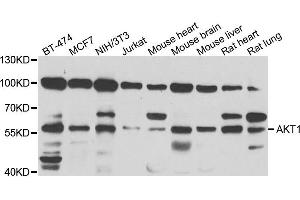 Western blot analysis of extracts of various cell lines, using AKT1 antibody.