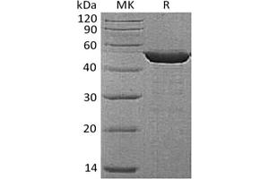 Western Blotting (WB) image for Enolase 1 (ENO1) protein (His tag) (ABIN7319760) (ENO1 Protein (His tag))