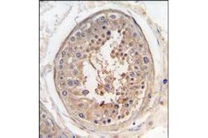 Formalin-fixed and paraffin-embedded human testis tissue reacted with SPAG9 antibody (Center), which was peroxidase-conjugated to the secondary antibody, followed by DAB staining (SPAG9 antibody  (Middle Region))