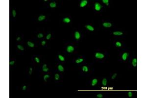 Image no. 3 for anti-N-Methylpurine-DNA Glycosylase (MPG) (AA 1-90) antibody (ABIN598820) (MPG antibody  (AA 1-90))