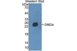 Detection of Recombinant LAMb3, Mouse using Polyclonal Antibody to Laminin Beta 3 (LAMb3) (Laminin beta 3 antibody  (AA 595-778))