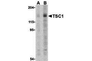 Western Blotting (WB) image for anti-Tuberous Sclerosis 1 (TSC1) (C-Term) antibody (ABIN1030780) (TSC1 antibody  (C-Term))