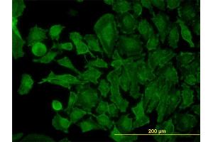 Immunofluorescence of monoclonal antibody to STX4A on HeLa cell. (Syntaxin 4 antibody  (AA 19-119))