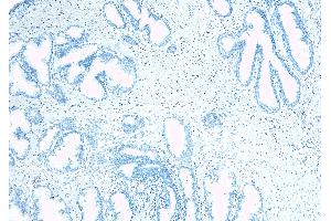 Immunohistochemistry (IHC) image for anti-Kallikrein 2 (KLK2) (Internal Region) antibody (ABIN190842)