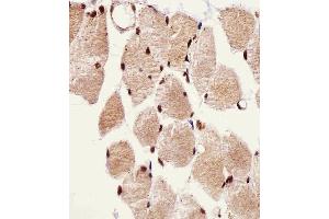 Immunohistochemical analysis of paraffin-embedded H. (SSNA1 antibody  (N-Term))