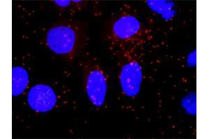Proximity Ligation Analysis of protein-protein interactions between AKT1 and SMAD4. (SMAD4 antibody  (AA 56-165))