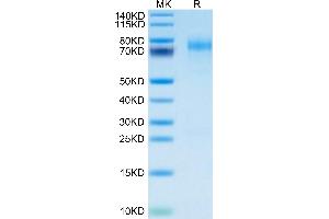 Mouse LYPD3 on Tris-Bis PAGE under reduced condition. (LYPD3 Protein (AA 33-287) (His tag))