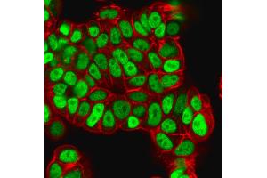 Immunofluorescence Analysis of PFA-fixed MCF-7 cells labeled with FOXA1 Mouse Monoclonal Antibody (FOXA1/1512) followed by goat anti- mouse IgG-CF488. (FOXA1 antibody  (AA 372-472))