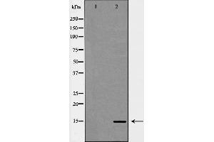 Western blot analysis of extracts of HeLa, using H3K14me3 antibody. (Histone 3 antibody  (H3K14me3))