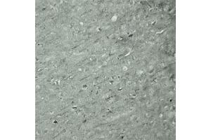 IHC on mouse brain (cryo section) using Rabbit antibody to Synaptotagmin 17  at a concentration of 50 µg/ml incubated overnight at 4C. (SYT17 antibody  (Internal Region))