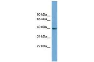 Image no. 1 for anti-Guanine Nucleotide Binding Protein (G Protein), alpha Inhibiting Activity Polypeptide 3 (GNAI3) (AA 43-92) antibody (ABIN6745517) (GNAI3 antibody  (AA 43-92))