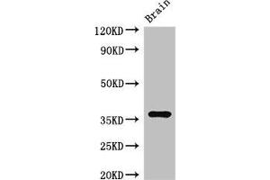 Western Blot Positive WB detected in: Mouse brain tissue All lanes: RNF126 antibody at 2. (RNF126 antibody  (AA 39-225))