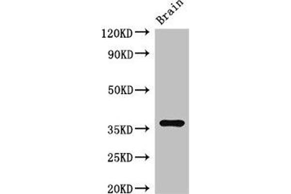 RNF126 antibody  (AA 39-225)