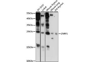 Western blot analysis of extracts of various cell lines, using ZNRF1 antibody (ABIN7271433) at 1000 dilution. (ZNRF1 antibody  (AA 1-170))
