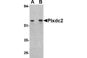 Western Blotting (WB) image for anti-Plexin Domain Containing 2 (PLXDC2) (C-Term) antibody (ABIN1030593) (PLXDC2 antibody  (C-Term))