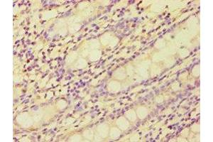 Immunohistochemistry of paraffin-embedded human colon tissue using ABIN7149359 at dilution of 1:100 (BMX antibody  (AA 65-280))