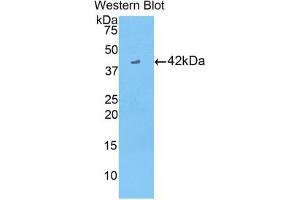 Western blot analysis of the recombinant protein. (CKB antibody  (AA 11-367))
