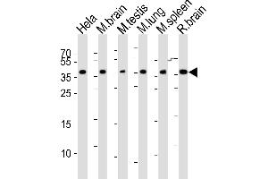 Western blot analysis of lysates from Hela cell line, mouse brain, mouse testis, mouse lung, mouse spleen, rat brain tissue (from left to right), using Mouse Cbx7 Antibody (C-term) (ABIN6243434 and ABIN6577610).