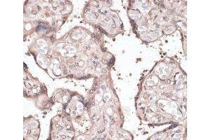 Immunohistochemistry of paraffin-embedded Human placenta using CCNE2 Polyclonal Antibody at dilution of 1:100 (40x lens). (Cyclin E2 antibody)