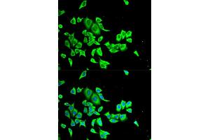 Immunofluorescence analysis of HeLa cells using SERPINB1 antibody (ABIN5973688). (SERPINB1 antibody)