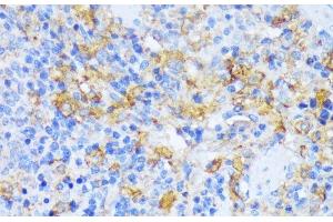 Immunohistochemistry of paraffin-embedded Rat spleen using AARS Polyclonal Antibody at dilution of 1:100 (40x lens). (AARS antibody)