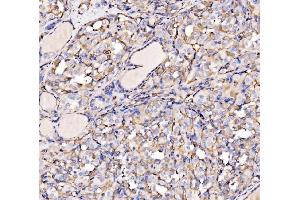 IHC analysis of HECTD1 using anti-HECTD1 antibody (ABIN7601584). (HECTD1 antibody  (AA 39-566))