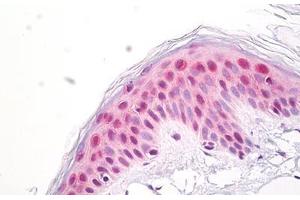 Anti-MP-44 / NUP53 antibody IHC staining of human skin, epidermis. (NUP35 antibody  (AA 50-100))