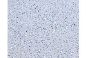 IHC analysis of B Raf/BRAF using anti-B Raf/BRAF antibody (ABIN3043761).