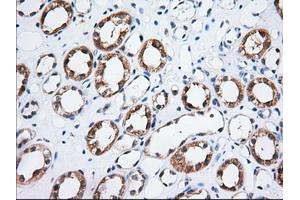 Immunohistochemical staining of paraffin-embedded Human Kidney tissue using anti-TTC32 mouse monoclonal antibody. (TTC32 antibody)