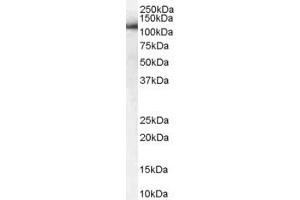 Western Blotting (WB) image for anti-USO1 Homolog, Vesicle Docking Protein (USO1) (AA 961-972) antibody (ABIN297849)
