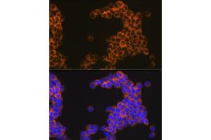 Immunofluorescence analysis of Jurkat cells using CD30 Rabbit mAb (ABIN7271072) at dilution of 1:100 (40x lens). (TNFRSF8 antibody)
