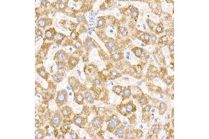 Immunohistochemistry of paraffin-embedded human liver using NDUFB9 Rabbit mAb (ABIN7268815) at dilution of 1:200 (40x lens). (NDUFB9 antibody)