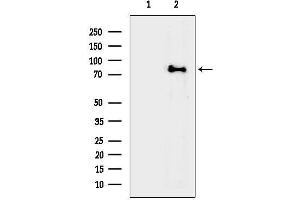 anti-Acyl-CoA Synthetase Long-Chain Family Member 4 (ACSL4) (N-Term) antibody