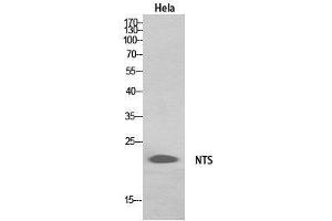 Western Blot (WB) analysis of HeLa, HepG2 cells using Neurotensin Polyclonal Antibody. (Neurotensin antibody  (Internal Region))