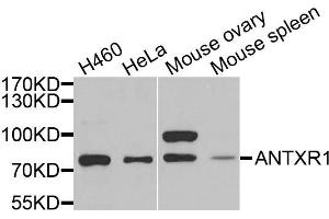 Western blot analysis of extracts of various cells, using ANTXR1 antibody.