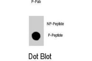 Dot blot analysis of GATA6 (phospho Y271) polyclonal antibody  on nitrocellulose membrane.