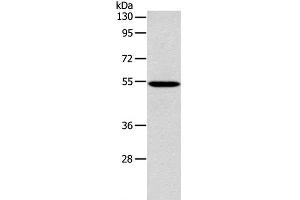Western Blot analysis of 293T cell using ERG Polyclonal Antibody at dilution of 1:650