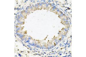Immunohistochemistry of paraffin-embedded mouse lung using CALU antibody at dilution of 1:100 (x40 lens). (CALU antibody)