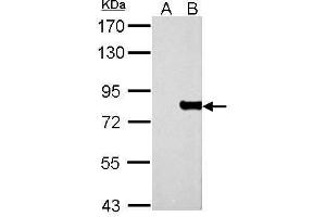 WB Image MX1 antibody detects MX1 protein by Western blot analysis. (MX1 antibody  (Center))