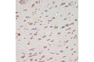 Immunohistochemistry of paraffin-embedded rat brain using SERPINI1 antibody (ABIN7270251) at dilution of 1:200 (40x lens). (Neuroserpin antibody  (AA 181-410))