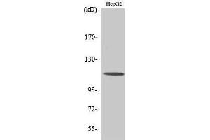 Western Blotting (WB) image for anti-CAP-GLY Domain Containing Linker Protein 2 (CLIP2) (C-Term) antibody (ABIN3174441) (CLIP2 antibody  (C-Term))