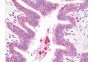 Anti-Delta3 / DLL3 antibody IHC staining of human lung. (DLL3 antibody  (AA 519-548))