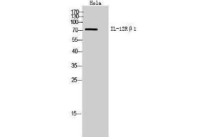 Western Blotting (WB) image for anti-Interleukin 12 Receptor beta 1 (IL12RB1) (Internal Region) antibody (ABIN3181454) (IL12RB1 antibody  (Internal Region))