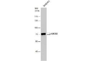 WB Image ABCD2 antibody detects ABCD2 protein by western blot analysis. (Abcd2 antibody)