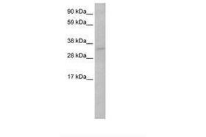 Image no. 1 for anti-Tumor Protein P53 (TP53) (AA 281-330) antibody (ABIN202409) (p53 antibody  (AA 281-330))